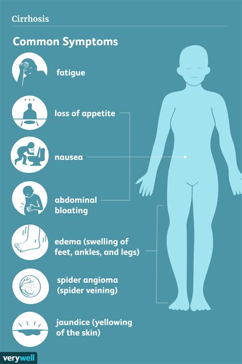 Liver Cirrhosis Symptoms