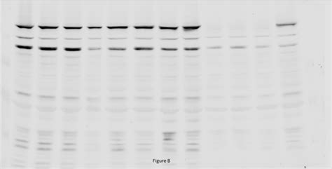 What happens on my western blot membrane? | ResearchGate