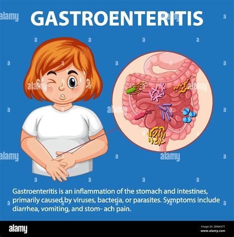 Cartoon infographic depicting symptoms of gastroenteritis in a chubby ...