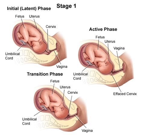 Labor - Stanford Medicine Children's Health