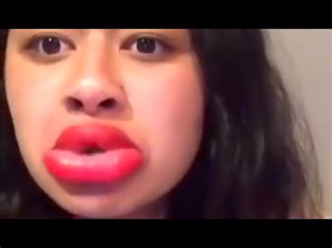 Yikes! This is What a Kylie Jenner Lip Challenge Fail Looks Like Check ...