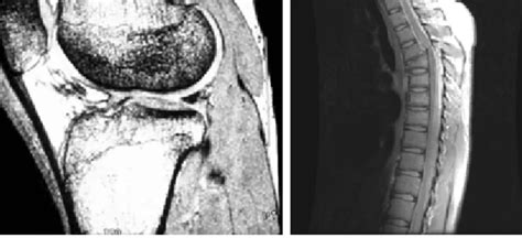 Examples in which Other Imaging Modalities Are Used Although imaging in the electromagnetic ...