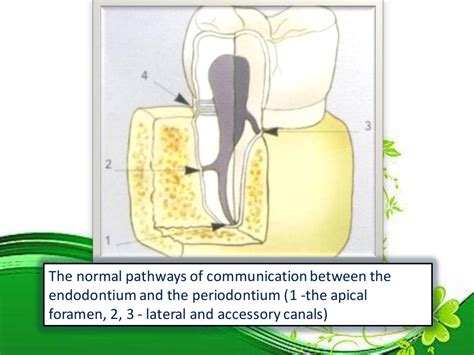 Endo perio lesions