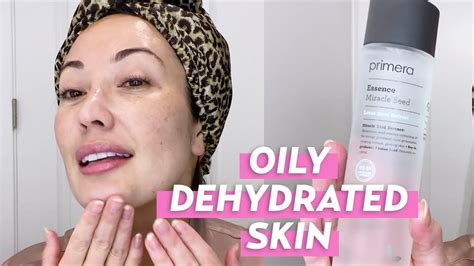 Dehydrated Skin