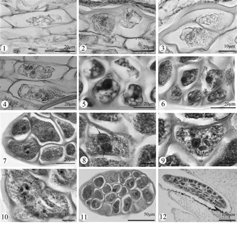 Plate II Microsporogenesis and male gametogenesis in Dregea sinensis... | Download Scientific ...