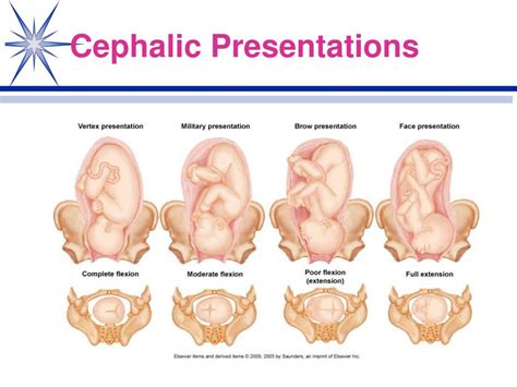 PPT - Normal Labor and Delivery Physiological Adaptations Chapter 17 PowerPoint Presentation ...