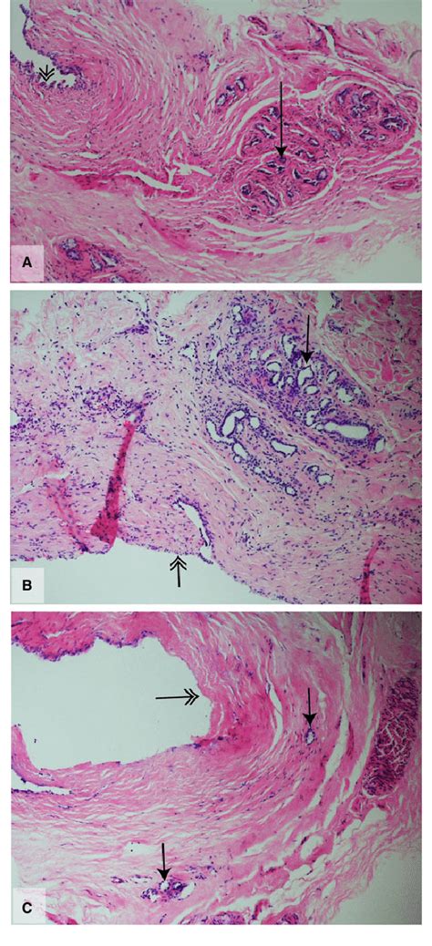 Bile duct histology. This figure demonstrates H&Estained sections of... | Download Scientific ...