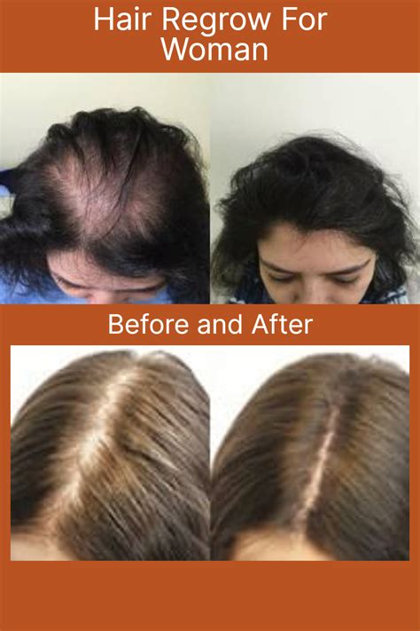 How to regrow hair black women – Artofit