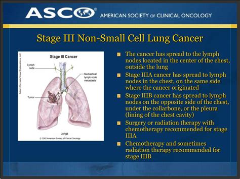 PPT - PLWC Slide Deck Series: Understanding Lung Cancer PowerPoint Presentation - ID:229291