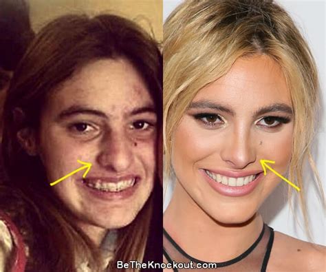 Lele Pons Plastic Surgery Comparison Photos