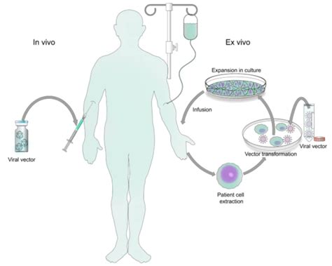 Targeted Gene Therapy Via Lentiviral Vectors - microbewiki