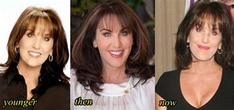 Robin McGraw before and after plastic surgery