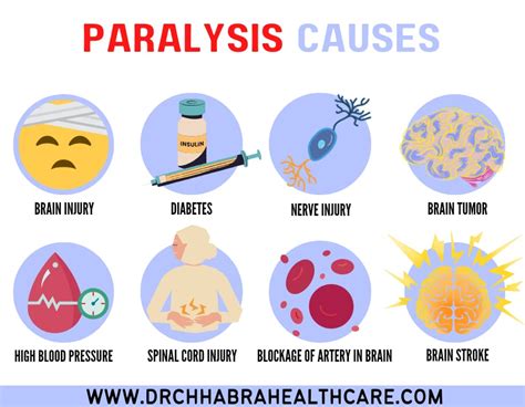 Paralysis : Symptoms, Treatment & Causes - Dr. Chhabra