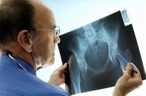 Orthopedic Surgeons: 7 Things You Need to Know | Penn Medicine