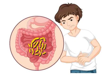 Gastrointestinal Stromal Tumor: Causes & Symptoms - TV Health