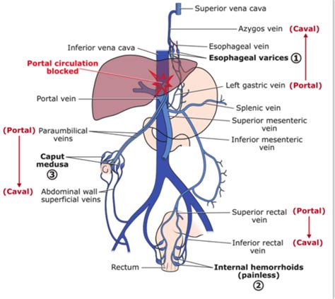 Portacaval Anastomoses Flashcards | Quizlet