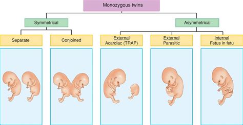 Multifetal Pregnancy - Williams Obstetrics, 24th Edition