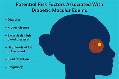 Diabetic Macular Edema: Types, Symptoms, Treatment