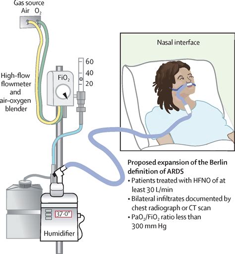 heated high flow oxygen therapy - Cherelle Ashe