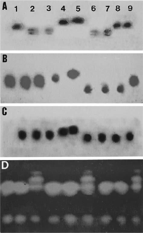 Isozyme patterns for four polymorphic enzymes in South African... | Download Scientific Diagram