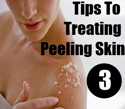 Treating Peeling Skin – Natural Home Remedies Fitness Guide