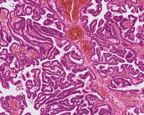 Choroid Plexus Histology