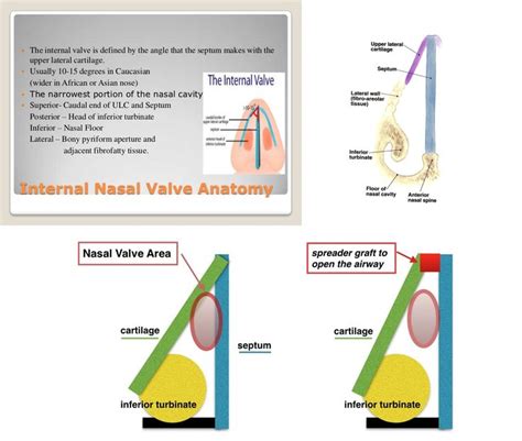 Nasal valve~Area - Narrowest portion of Nasal cavity ... Note: Boundaries | Nasal cavity ...