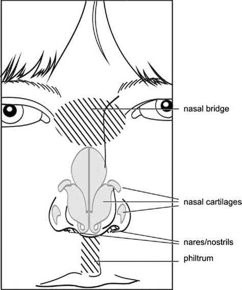 Elements of Morphology: Human Malformation Terminology