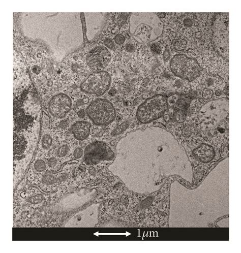 Electron microscopy of Wolbachia. (a) Wolbachia cocci (Scale bar:... | Download Scientific Diagram