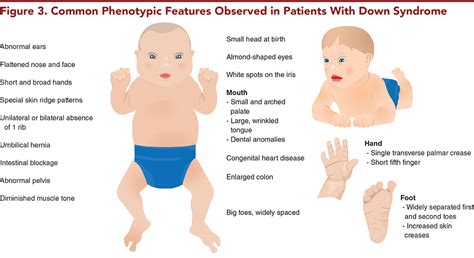 Spina Bifida, Down Syndrome, and Marfan Syndrome: Management Considerations in the ED