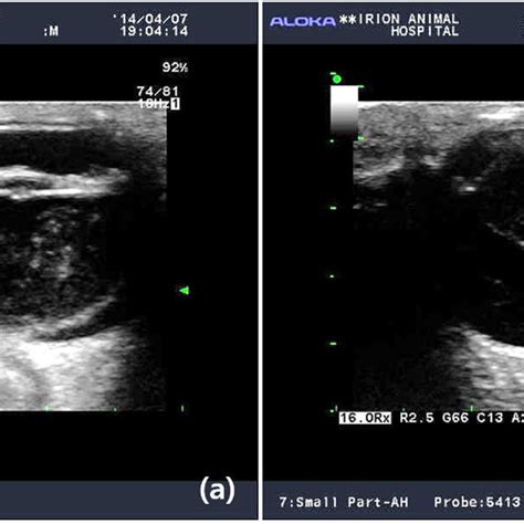 Results of electroretinography (ERG): The a-and b-waves were flat, and... | Download Scientific ...