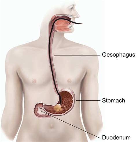 Colonoscopy Camera