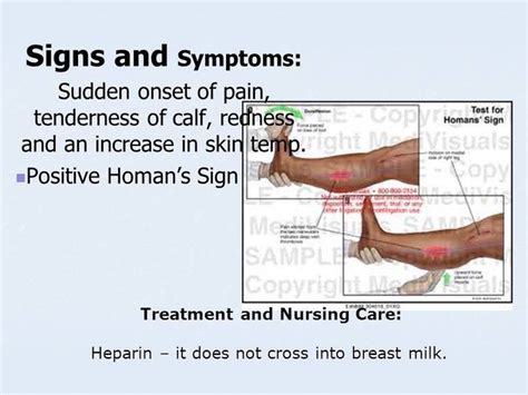 Pin by Andres Sanchez on Physical Exam | Homans sign, Nursing care ...