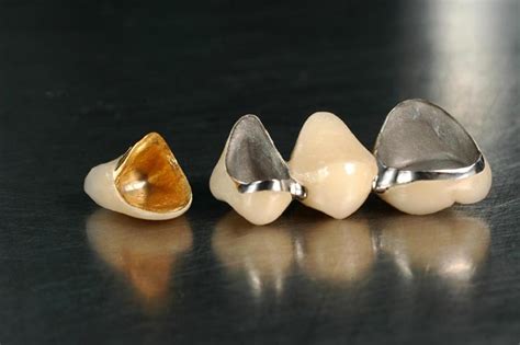 Litoral mereu Luminance dental crown metal ceramic bloc Lacrimi șuncă