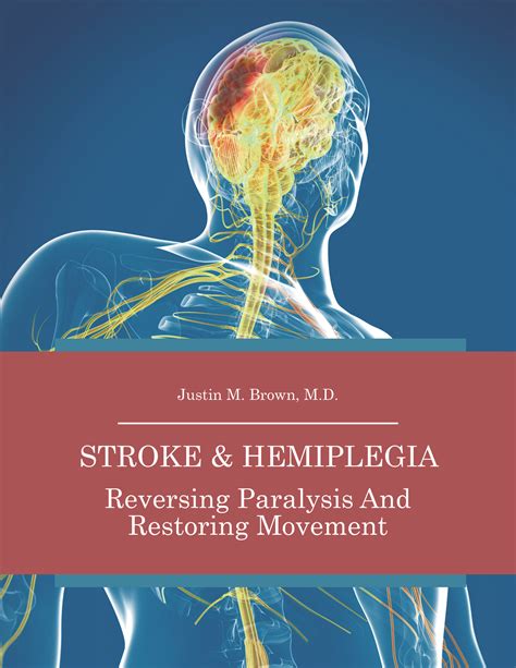 Stroke-hemiplegia-treatment-patient-guide-download — Paralysis Center