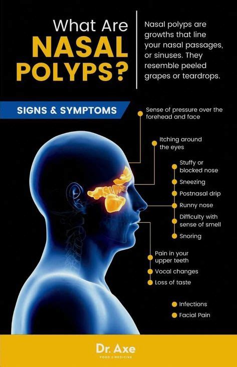 12 Polyps symptoms ideas | polyp, symptoms, sinus polyps