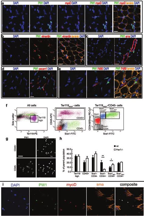 Figure S1 a-e. PICs are negative for markers of skeletal muscle, smooth... | Download Scientific ...