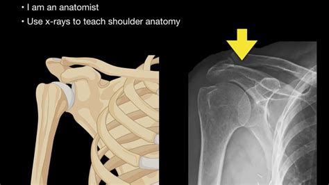 Anatomy of Shoulder X-rays - YouTube