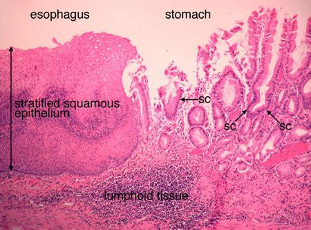 Gastroesophageal Junction Histology Labeled