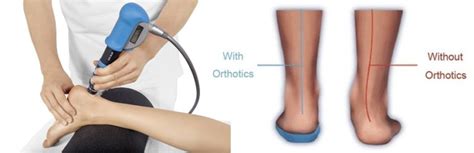 Insertional_Achilles_Tendinopathy - Podiatry First