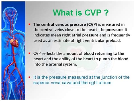 HEMODYNAMIC MONITORING In the CRITICAL CARE UNIT M