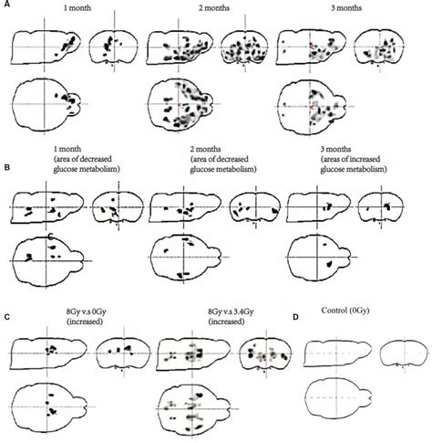 Measurement of glucose metabolism of the brain of both cohorts through ...