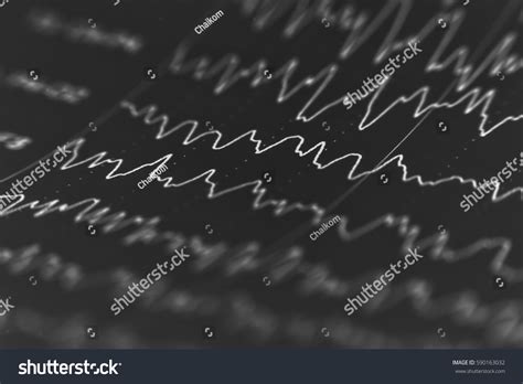 Eeg Wave Backgroundbackground Abnormal Eegbrain Wave Stock Photo (Edit ...