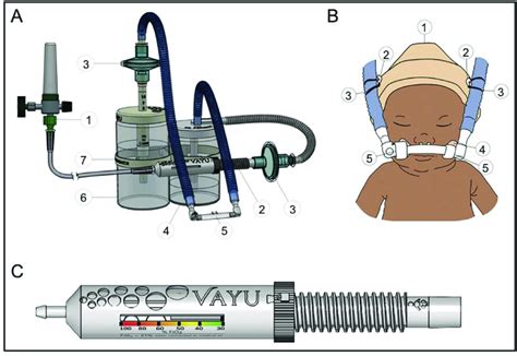 A: Vayu The bubble CPAP System is composed of (1) an external ...