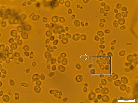 Fantastic Fungi Featurette: Specimen #11: Yeast