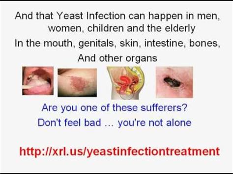 Easy Yeast Infection Treatment Home Remedy! - YouTube