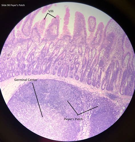 Peyer's Patch Histology.