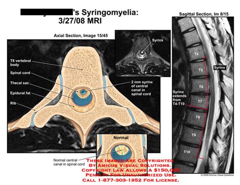 Medical Exhibits, Demonstrative Aids, Illustrations and Models