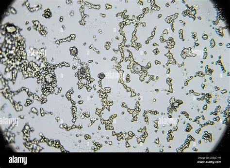 Mold spores under the light microscope, orange peel mold, magnification 400 times Stock Photo ...