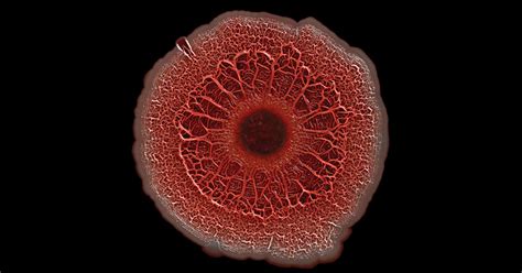 Snapshots of Life: Portrait of a Bacterial Biofilm – NIH Director's Blog